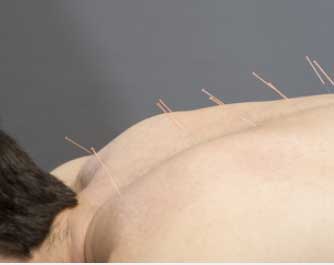 rendez-vous avec le docteur Celtao Acupuncture